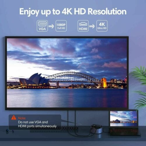 Mini DisplayPort to HDMI/VGA/DVI Adapter – 3-in-1 Multiport Converter